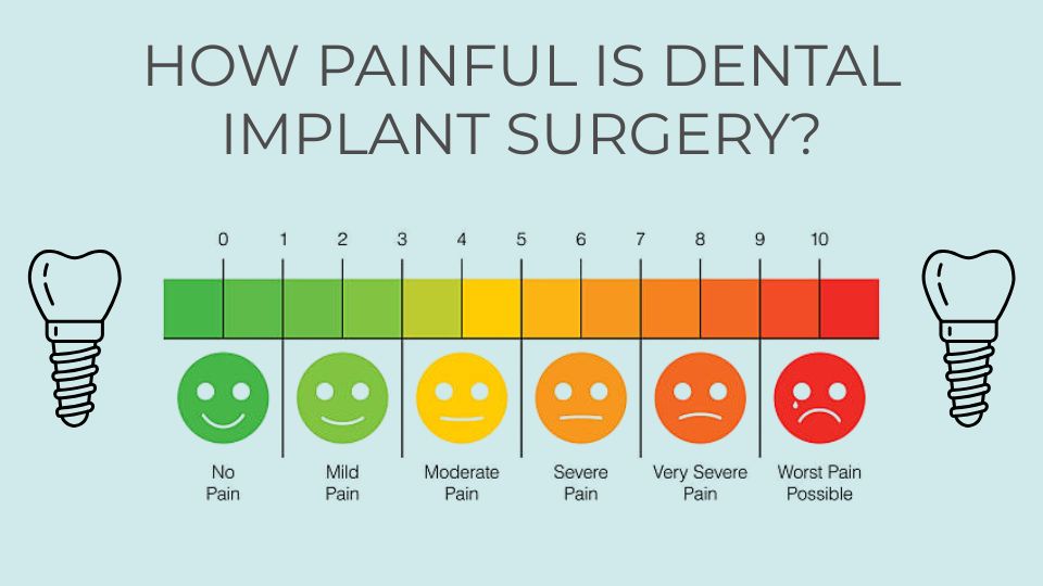 How Painful is Dental Implant Surgery? How Painful is Dental Implant Surgery?