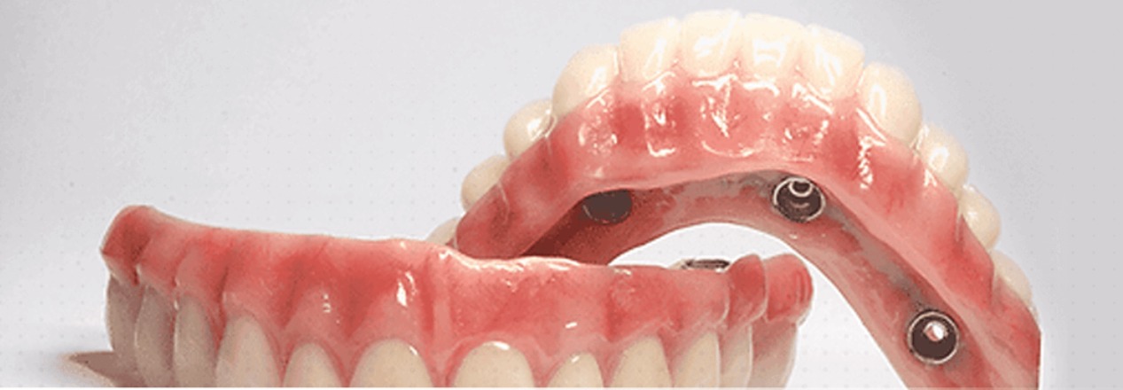 Dentures Dentures