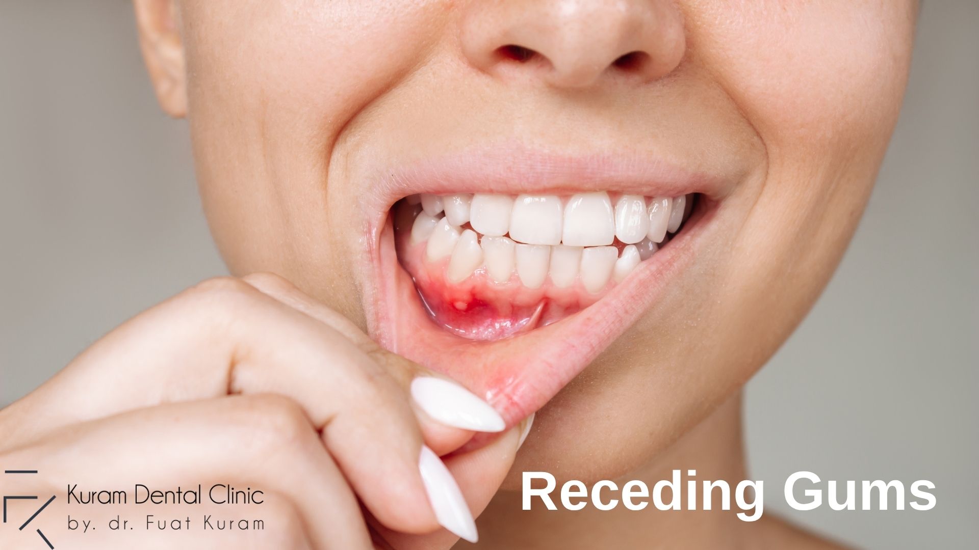 receding-gums-treatments-turkey